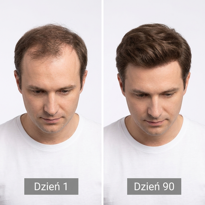 Czapka z czerwonym światłem na wzrost włosów