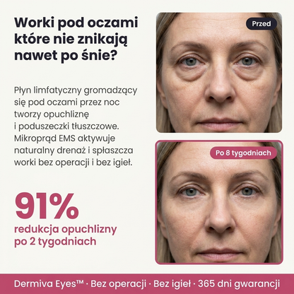Urządzenie do Likwidacji Worków i Cieni pod oczami Dermiva
